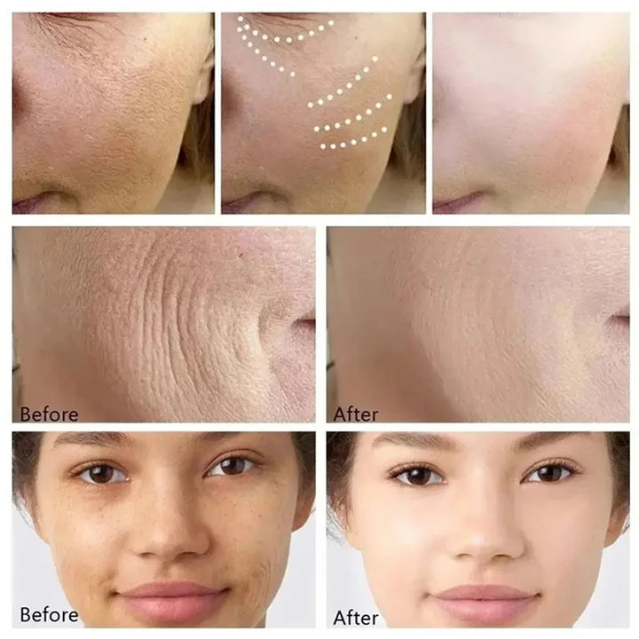 máscara facial anti rugas